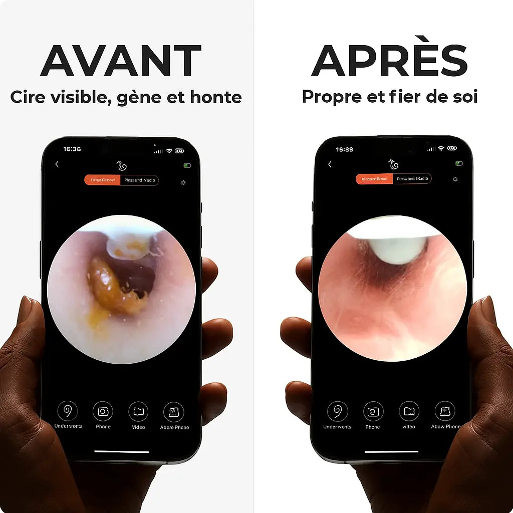 ZOREA VISON 2.0 Zorea